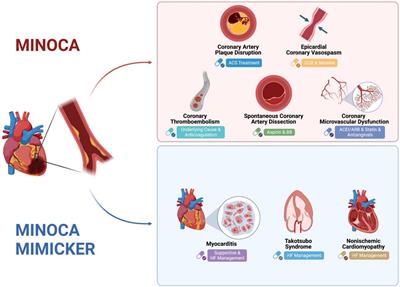 Myocardial infarction with non-obstructive coronary arteries (MINOCA)
